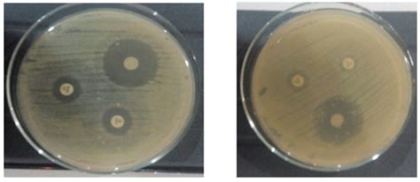 3 escherichia coli biomedical test.